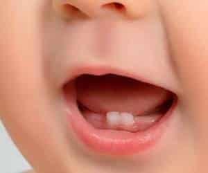 مراحل رشد دندان کودک